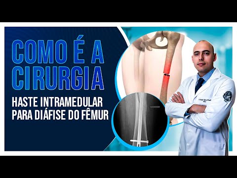 Vídeo: O sangramento de implantação pode preencher uma almofada?