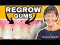 How to regrow receding gums fix gum recession at home