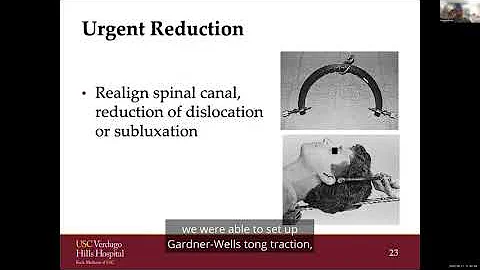 Emergent Spine Conditions: Spine Fractures