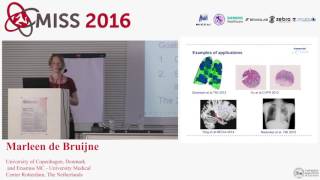 [MISS 2016] Marleen de Bruijne - Learning from Weak Labels screenshot 1