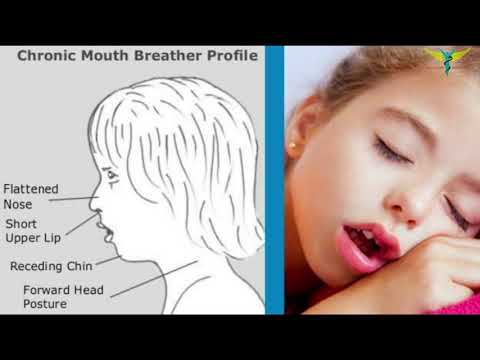 Video: Granular Pharyngitis - Symptoms, Treatment