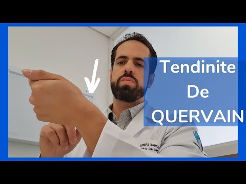 Tendinite "De Quervain" - Tratamento Conservador