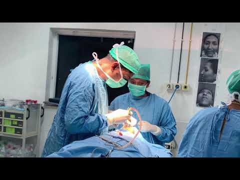 You got to break it to make it - bitter truth in some rhinoplasty surgeries - Dr Sunil Richardson