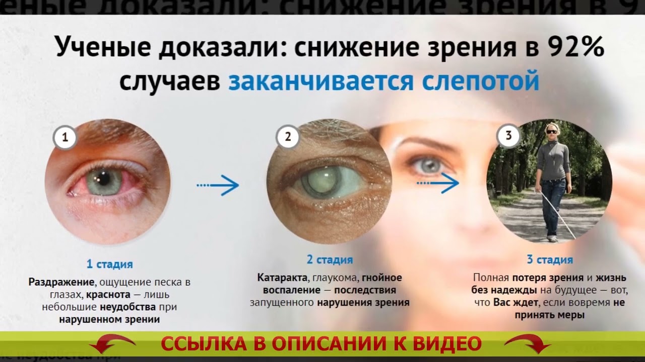 Когда после замены хрусталика восстанавливается зрение глаза. Понижение зрения. Снижение остроты зрения. Ухудшение человеческого зрения.