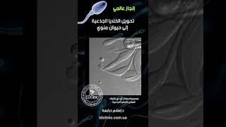 انجاز علمي غير مسبوق لعلاج العقم باستخدام الخلايا الجذعية 2019 | إسلام دبابسة | I.D.Clinic