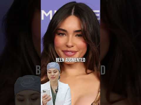Madison Beer Before After Plastic Surgery Let S Find Out Dr Wendy Wong