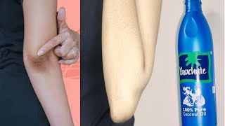 How to get rid of black knees and dark elbows | Elbow whitening at home | Coconut oil for skin care