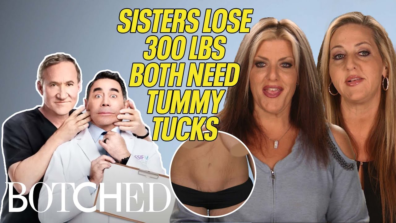 Sisters Get Tummy Tucks TOGETHER on Sagging Breasts & Fupa | Botched | E!