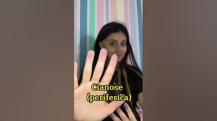 Choque Hipovolmico  #anlisesclnicas #saude #ensino...