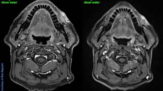 Twist Vibe Head Neck Imaging