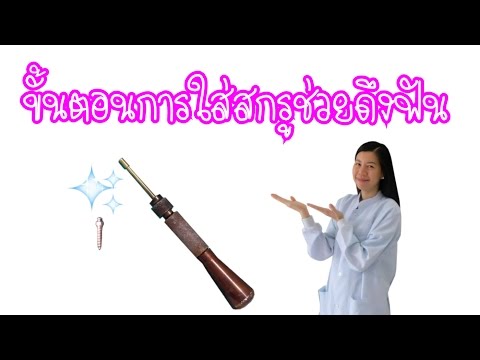 ขั้นตอนการปักสกรูช่วยดึงฟัน