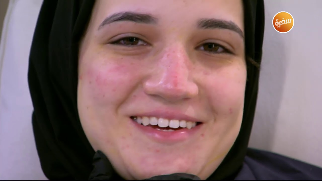 علاج انتفاخ واسمرار تحت العين بحقن الفيلر مع دكتور طاهرة لهيطة | هي وبس