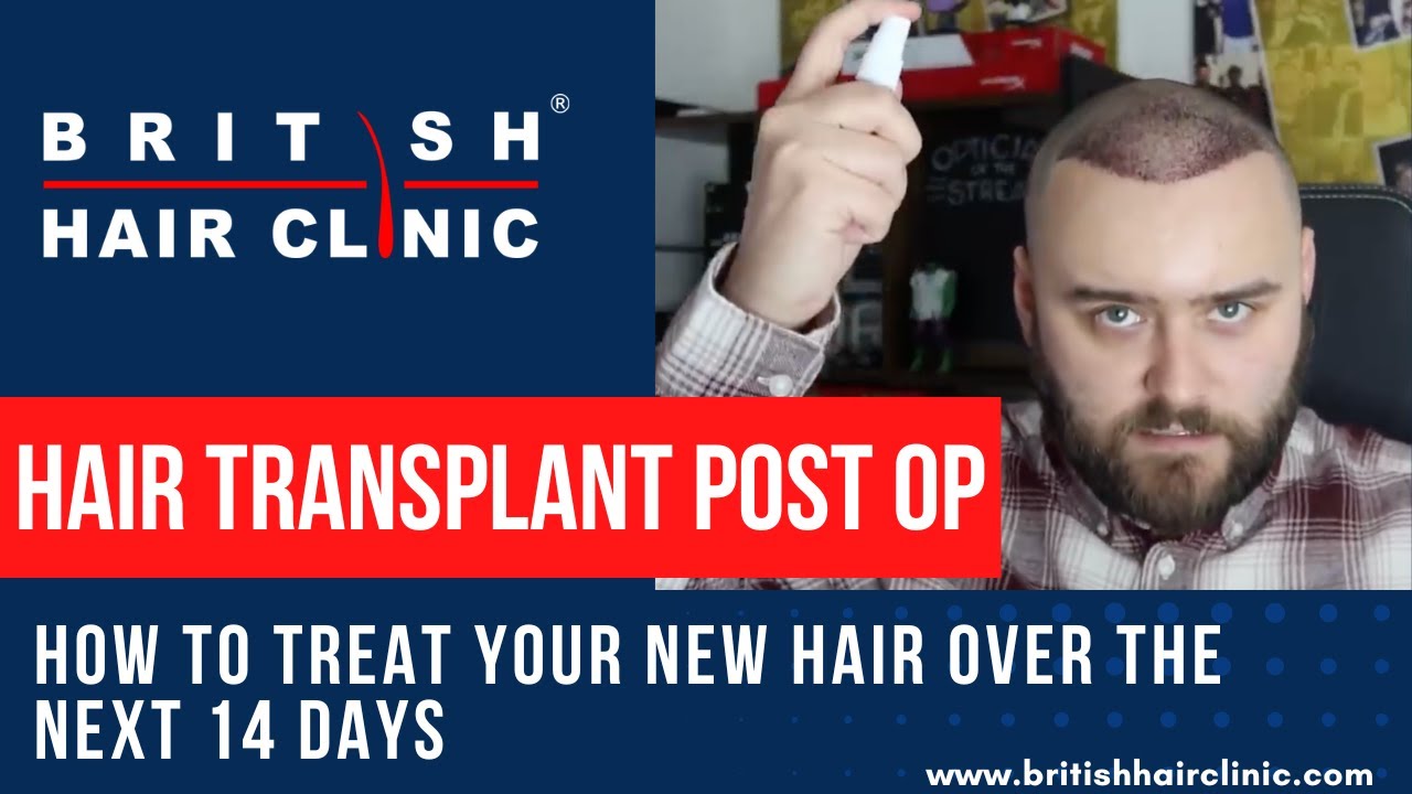 Hair Transplant Treatment | Hair Regrowth | FUE Hair Treatment