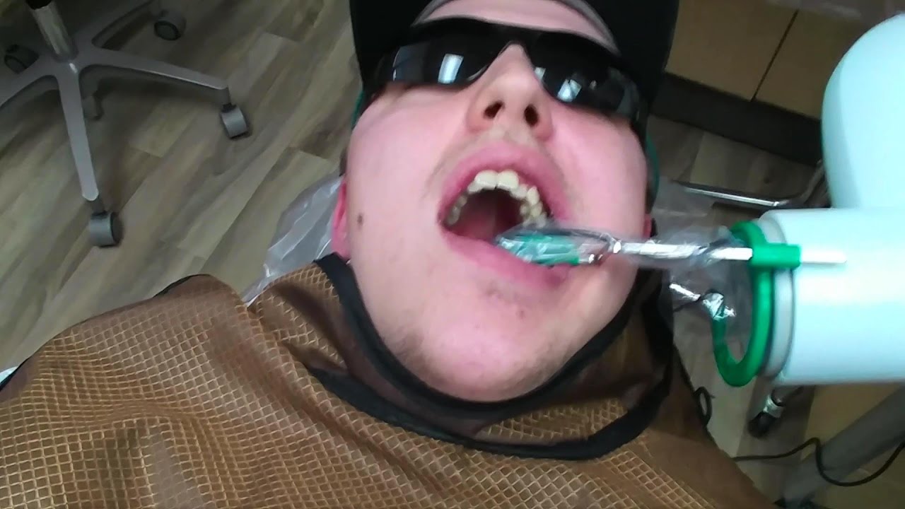 Root Canal YouTube