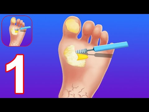 Foot Clinic - ASMR Feet Care - Gameplay Walkthrough Part 1 (Android, iOS)