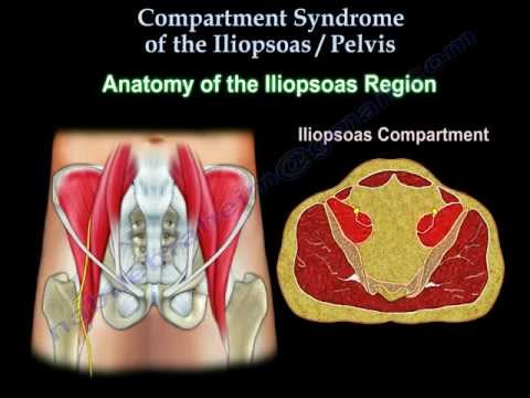 Iliopsoas, Pelvic Compartment Syndrome- Everything You Need To Know- Dr. Nabil Ebraheim