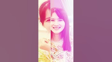 Bọc Răng Sứ Có Thể Khiến Nụ Cười Đẹp Đến Mức Nào? Làm Răng Sứ Thẩm Mỹ | Nha Khoa Thẩm Mỹ Răng Sứ