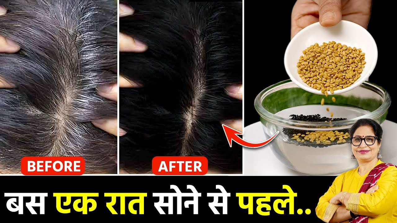 गारंटी है! रात में सोने से पहले लगा लो, जिंदगी मे कभी बाल सफेद नही होंगे | Baal Kale Karne Ka Tarika