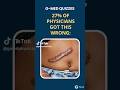 27% of Physicians Missed This Scar Diagnosis | Medical Quiz