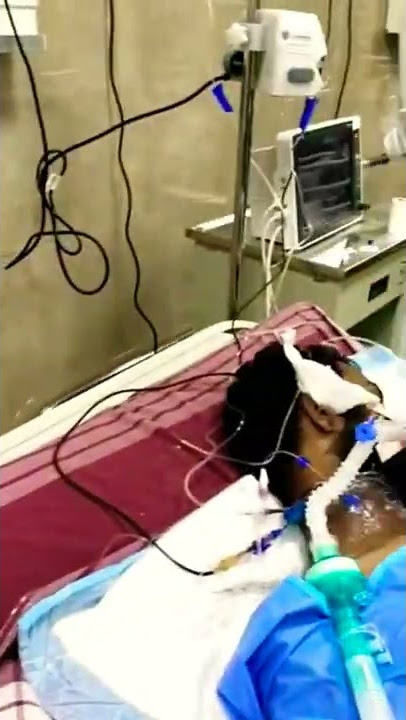 Off Of Mechanical Ventilator   #medical #nursing #hospital