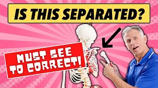 Is Your Shoulder Separated? All You Need To Know!