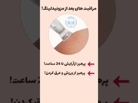 مراقبت بعد از مزونیدلینگ