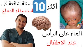 الاستسقاء الدماغى او الماء على المخ عند الاطفال | اسئلة شائعة لاستسقاء المخ | دكتور علاج طبيعي اطفال