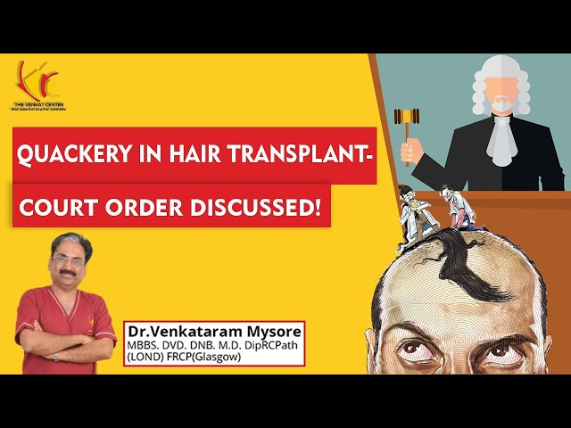 Death due to Hair transplantation |Black marketing on Hair transplantation