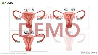 [Demo] c0063aako [Korean Society of Obstetrics and Gynecology] Guide to Infertility Treatment by ...