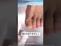 【肥厚爪ケア】#shorts
