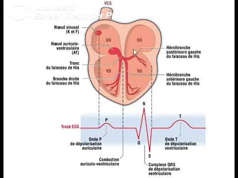 LECG partie 1  comment obtenir un trac ECG