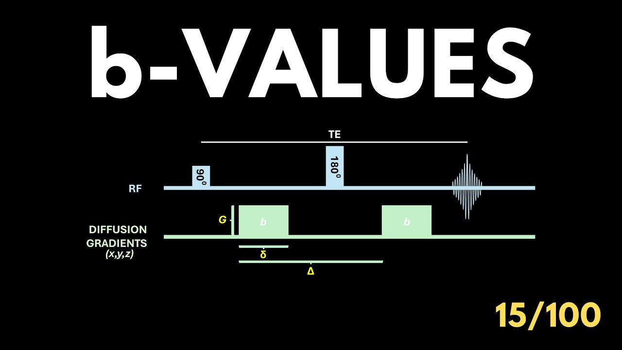 What is a b-Value in MRI? | Diffusion Weighted Imaging Explained - YouTube