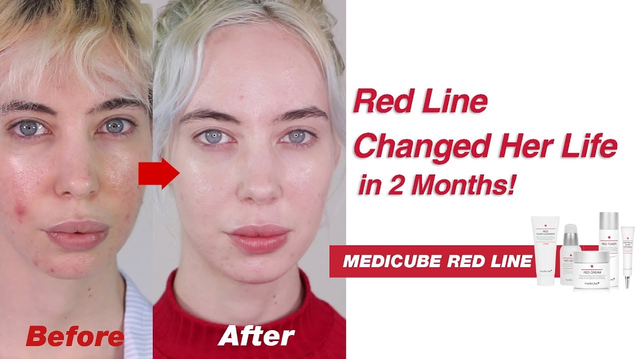 medicube red line