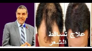 وصفة طبيعية علاج تساقط الشعر    الدكتور محمد الفايد Dr Mohamed FAID