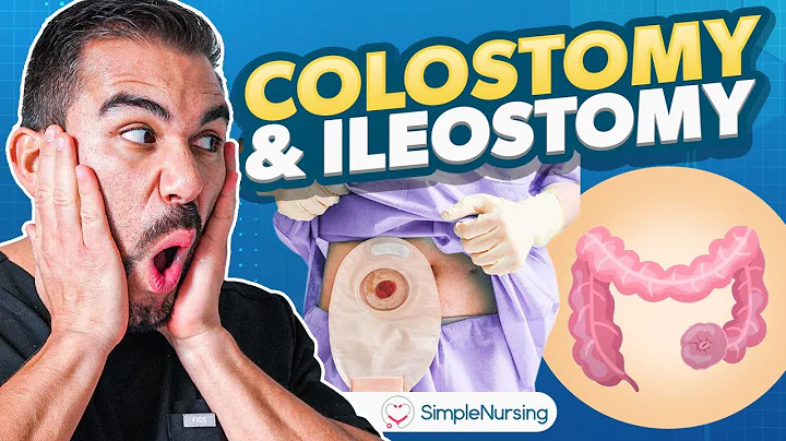 Short Colostomy & Ileostomy Video