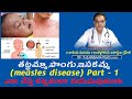 Measels disease (తట్టమ్మా,పొంగు,ఇసకమ్మ) | Symptoms | Causes | Homeopathy medicines | treatment