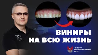 Виниры для зубов. Как ставят виниры, и когда нельзя их ставить?