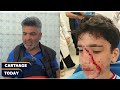 حادثة باب الخضراء طفل الـ12 سنة يخرج من معهد خاص بوجه م شو ه تفاصيل على لسان الاب