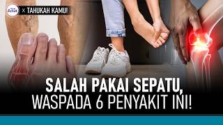 6 Masalah Kesehatan Akibat Salah Pakai Sepatu | Hidup Sehat tvOne