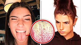 Charli D'Amelio MOST EMBARRASSING MOMENTS You Won't Believe!