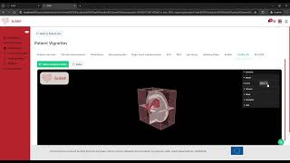 AI4HF   Doctor   APP   Cardiac   MPR   Paint screenshot 3
