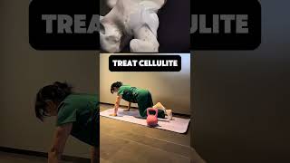 TREAT CELLULITIS 🔥✨ #1million
