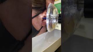 Removing Ear Wax using The Earigator™ at Hearing HealthCare Centers, Broomfield, CO screenshot 4