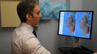 3-D cosmetic surgery simulation by Dr. Kotlus