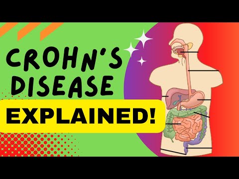 Video: Hur man diagnostiserar och behandlar Crohns sjukdom: 9 steg (med bilder)