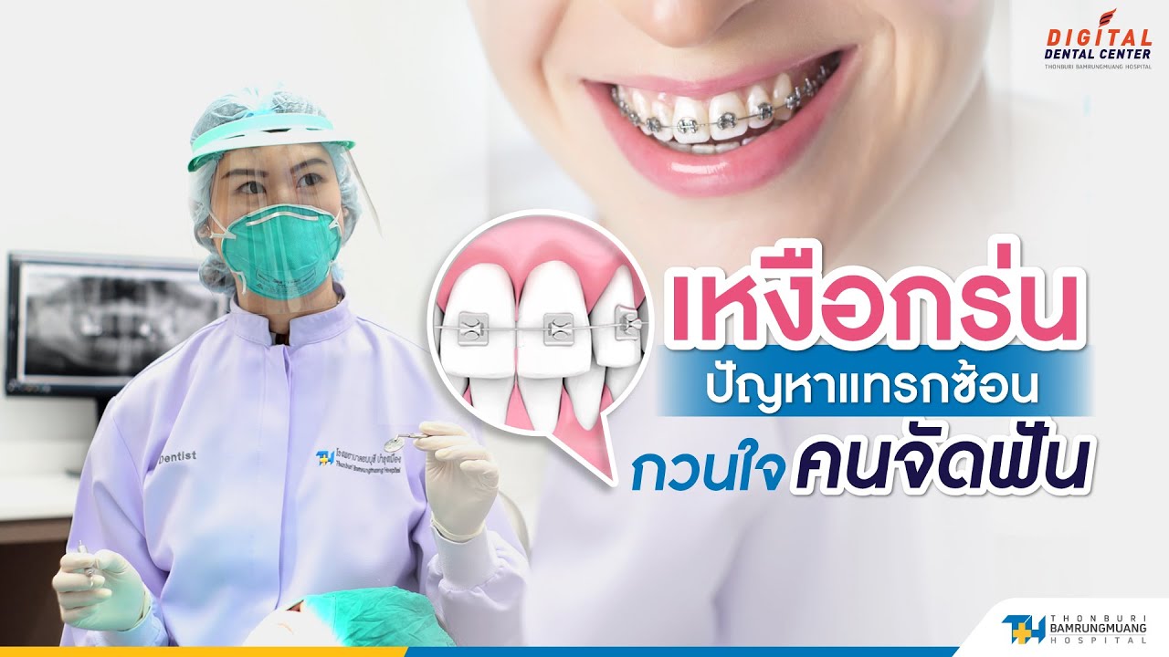 เหงือกร่น ปัญหาแทรกซ้อน กวนใจคนจัดฟัน | 𝐃𝐢𝐠𝐢𝐭𝐚𝐥 𝐃𝐞𝐧𝐭𝐚𝐥 𝐂𝐞𝐧𝐭𝐞𝐫