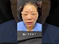 50代「腫れレベルMAX切開リフト」ダウンタイム翌日から１ヶ月後まで#shorts