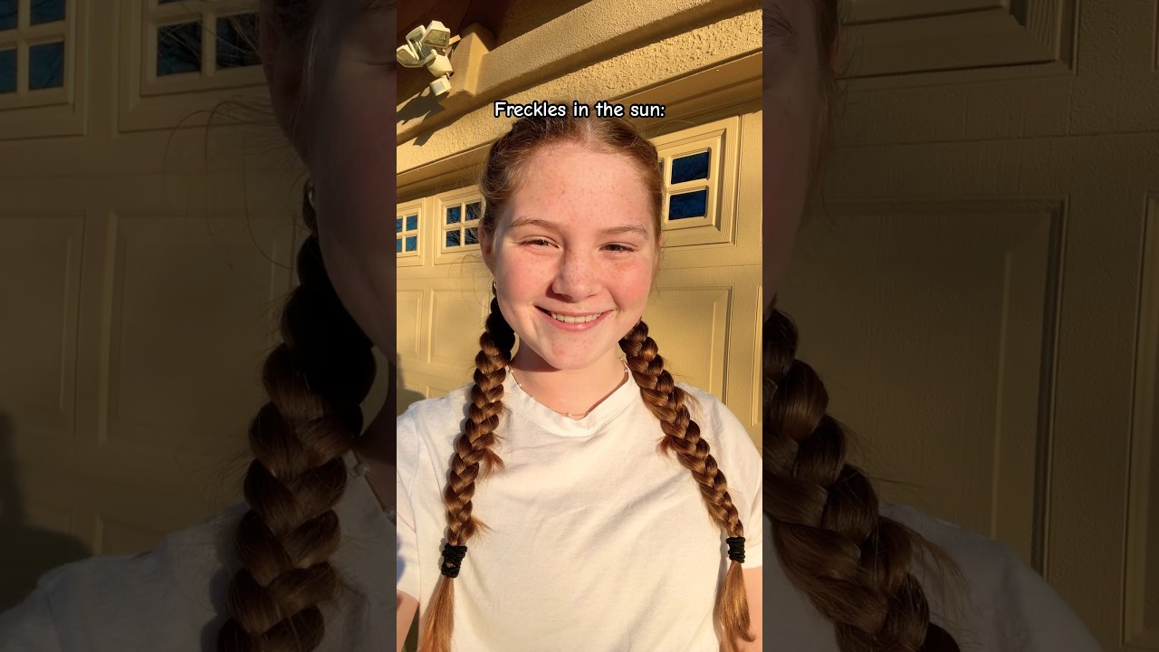 Freckles in shade vs freckles in sun ☀️ credits:@itspaytonslife 