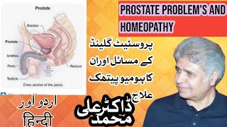 Prostate Problems and Homeopathy | Hindi and Urdu | Dr.Ali Muhammad