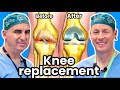 Knee replacement  how to know if you need one